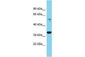 Western Blotting (WB) image for anti-Proteasome (Prosome, Macropain) 26S Subunit, Non-ATPase, 7 (PSMD7) (C-Term) antibody (ABIN2788039)