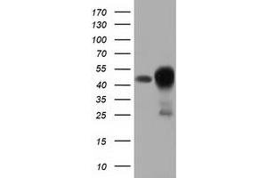 Western Blotting (WB) image for anti-DnaJ (Hsp40) Homolog, Subfamily A, Member 2 (DNAJA2) antibody (ABIN1497864)