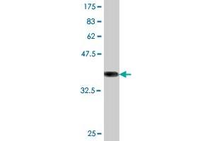 Western Blot detection against Immunogen (36. (ATG5 Antikörper  (AA 176-275))