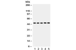 Western blot testing of 1) rat liver, 2) mouse liver, 3) human SMMC, 4) RH35 and 5) HepG2 lysate with YB1 antibody. (YBX1 Antikörper)