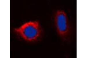Immunofluorescent analysis of Calnexin (pS583) staining in HeLa cells. (Calnexin Antikörper  (C-Term, pSer583))