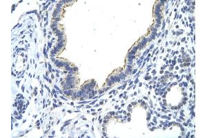Rabbit Anti-DDX21 antibody   Paraffin Embedded Tissue: Human Lung cell Cellular Data: cilia of renal tubule Antibody Concentration: 4. (DDX21 Antikörper  (N-Term))
