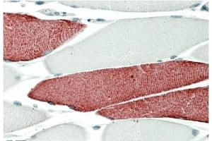 AP32711PU-N TNNI3 Antibody staining of paraffin embedded Human Skeletal Muscle at 5 µg/ml. (TNNT3 Antikörper)