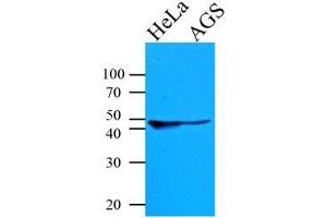 Cell lysates of HeLa and AGS (35 ug) were resolved by SDS-PAGE, transferred to PVDF membrane and probed with anti-human KRT18 (1:1000). (Cytokeratin 18 Antikörper  (AA 79-430))