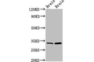Western Blot Positive WB detected in: Mouse brain tissue, Rat brain tissue All lanes: HAX1 antibody at 1. (HAX1 Antikörper  (AA 2-250))