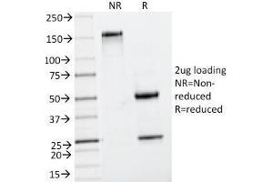 SDS-PAGE Analysis of Purified, BSA-Free Insulin Antibody (clone IRDN/794).