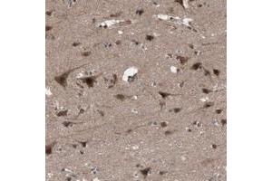 Immunohistochemical staining of human cerebral cortex with KANSL1 polyclonal antibody  shows strong cytoplasmic and nuclear positivity in neuronal cells. (KANSL1 Antikörper)
