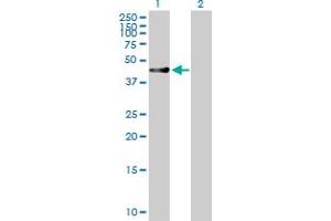 Western Blot analysis of RUSC1 expression in transfected 293T cell line by RUSC1 MaxPab polyclonal antibody. (RUSC1 Antikörper  (AA 1-433))