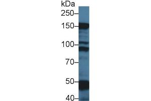 Western Blot; Sample: Rat Skeletal muscle lysate; Primary Ab: 1µg/ml Rabbit Anti-Mouse MYBPC1 Antibody Second Ab: 0.