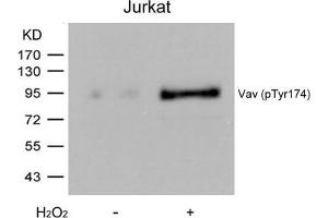 Western blot analysis of extracts from Jurkat cells untreated or treated with H2O2 using Vav(Phospho-Tyr174) Antibody. (VAV1 Antikörper  (pTyr174))