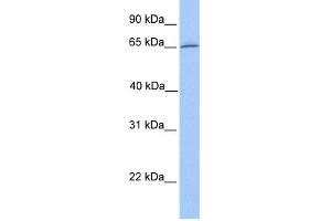 WB Suggested Anti-DYNC1I1 Antibody Titration: 0. (DYNC1I1 Antikörper  (N-Term))