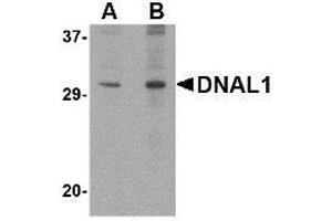 Western blot analysis of DNAL1 in 3T3 cell lysate with AP30294PU-N DNAL1 antibody at (A) 1 and (B) 2 μg/ml.
