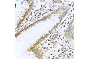 Immunohistochemistry of paraffin-embedded human stomach using TMEM189 antibody (ABIN6134447, ABIN6149262, ABIN6149263 and ABIN6224423) at dilution of 1:100 (40x lens). (TMEM189 Antikörper  (C-Term))