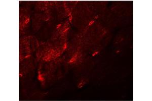 Immunofluorescence of TMEM38A in mouse skeletal muscle tissue with TMEM38A antibody at 20 μg/ml. (TMEM38A Antikörper  (C-Term))