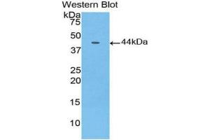 Western Blotting (WB) image for anti-Gastrointestinal Cancer Antigen CA19-9 (CA 19-9) (AA 35-361) antibody (ABIN5661981) (CA 19-9 Antikörper  (AA 35-361))
