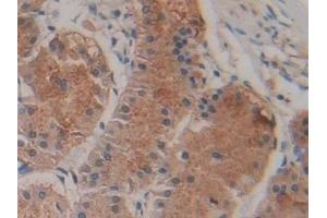 Immunohistochemistry (IHC) image for anti-ATP-Binding Cassette, Sub-Family A (ABC1), Member 1 (ABCA1) (AA 1385-1663) antibody (ABIN7433309)