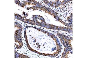 IHC analysis of SUMF2 using anti-SUMF2 antibody (ABIN7600954). (SUMF2 Antikörper  (AA 26-301))