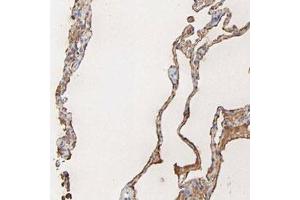 Immunohistochemical staining (Formalin-fixed paraffin-embedded sections) of human lung with PAG1 polyclonal antibody  shows cytoplasmic and membranous positivity in alveolar cells at 1:200-1:500 dilution.