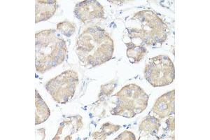 Immunohistochemistry of paraffin-embedded human stomach using CLUH antibody  at dilution of 1:100 (40x lens). (CLUH Antikörper  (AA 1120-1309))