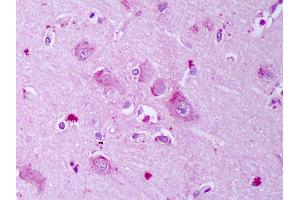 Anti-GABRB1 antibody IHC of human brain, cortex neurons. (GABRA1 Antikörper  (AA 327-450))