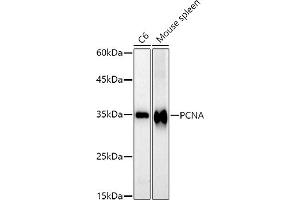 Western blot analysis of extracts of various cell lines, using PCNA antibody (ABIN6133630, ABIN6139020, ABIN6139022 and ABIN7101400) at 1:1000 dilution. (PCNA Antikörper)