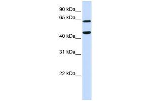 WB Suggested Anti-TRIM54 Antibody Titration:  0. (TRIM54 Antikörper  (N-Term))