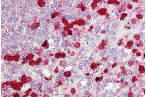 Anti-CLIC4 antibody IHC staining of human spleen. (CLIC4 Antikörper  (AA 1-50))