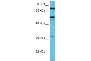 Host:  Mouse  Target Name:  TFE3  Sample Tissue:  Mouse Heart  Antibody Dilution:  1ug/ml (TFE3 Antikörper  (Middle Region))