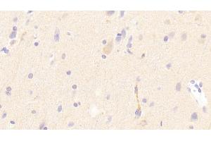 Detection of LDLR in Human Cerebrum Tissue using Polyclonal Antibody to Low Density Lipoprotein Receptor (LDLR) (LDLR Antikörper  (AA 497-742))