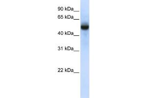 WB Suggested Anti-CXorf34 Antibody Titration:  0. (TRMT2B Antikörper  (N-Term))