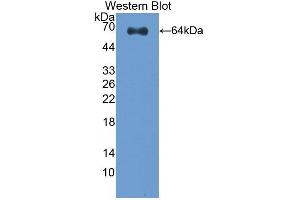 Detection of Recombinant CLEC11A, Human using Polyclonal Antibody to C-Type Lectin Domain Family 11, Member A (CLEC11A) (CLEC11A Antikörper  (AA 22-323))