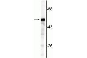 Western blot of NIH 3T3 cell lysate showing specific immunolabeling of the ~50 kDa Vimentin protein. (Vimentin Antikörper)