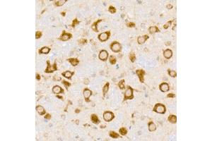 Immunohistochemistry of paraffin-embedded mouse brain using HDLBP Rabbit mAb (ABIN7267644) at dilution of 1:50 (40x lens).