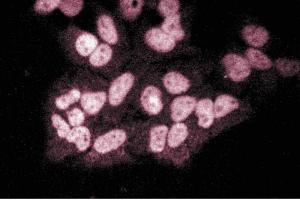 Immunofluorescent staining of Hela cells.
