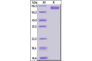 SDS-PAGE (SDS) image for Guanylate Cyclase 2C (Heat Stable Enterotoxin Receptor) (GUCY2C) (AA 24-430) (Active) protein (Fc Tag,AVI tag,Biotin) (ABIN6973083)