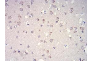 Immunohistochemical analysis of paraffin-embedded brain tissues using mTOR mouse mAb with DAB staining. (MTOR Antikörper  (AA 2311-2529))