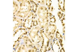 Immunohistochemistry of paraffin-embedded human kidney using MAPK3 Antibody (ABIN5970057) at dilution of 1/100 (40x lens).