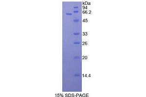 SDS-PAGE analysis of Human MAP2K4 Protein.