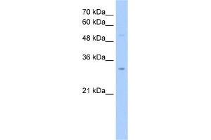 WB Suggested Anti-NSUN5C Antibody Titration:  2. (NSUN5P2 Antikörper  (Middle Region))