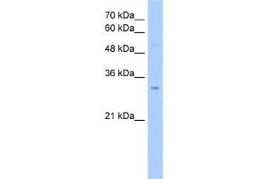WB Suggested Anti-NSUN5C Antibody Titration:  2. (NSUN5P2 Antikörper  (Middle Region))