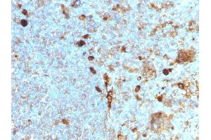 Formalin-fixed, paraffin-embedded human Tonsil stained with Alpha-1-Antitrypsin Mouse Monoclonal Antibody (AAT/1378). (SERPINA1 Antikörper)