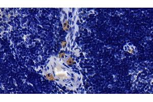 Immunohistochemistry (IHC) image for anti-Interleukin 1 Receptor, Type I (IL1R1) (AA 119-217) antibody (ABIN7430741)