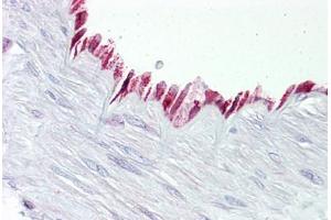Anti-PTGS1 / COX-1 antibody IHC staining of human vessel.