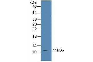 Detection of CCL6 in Human Hela Cells using Polyclonal Antibody to Chemokine (C-C motif) ligand 6 (CCL6) (CCL6 Antikörper  (AA 21-115))