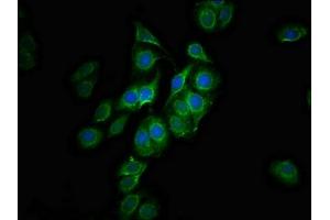 Immunofluorescence staining of HepG2 cells with ABIN7147479 at 1:100, counter-stained with DAPI. (GLTPD1 Antikörper  (AA 1-214))