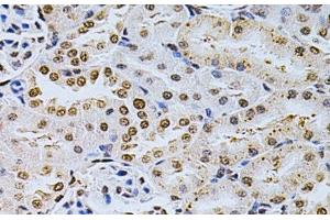 Immunohistochemistry of paraffin-embedded Rat kidney using MDM2 Polyclonal Antibody at dilution of 1:200 (40x lens). (MDM2 Antikörper)