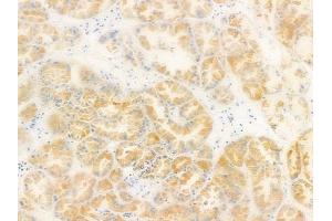 ABIN6264828 and ABIN6278632 at 1/100 staining human normal kidney tissue by IHC-P. (RPL14 Antikörper  (Internal Region))