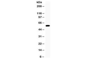 Western blot testing of 22RV1 cell lysate (prostate carcinoma) with CYP17A1 antibody at 0. (CYP17A1 Antikörper  (AA 383-419))