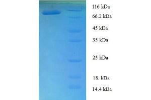 SDS-PAGE (SDS) image for T-Box 18 (TBX18) (AA 1-607), (full length) protein (His-SUMO Tag) (ABIN5710464) (T-Box 18 Protein (TBX18) (AA 1-607, full length) (His-SUMO Tag))