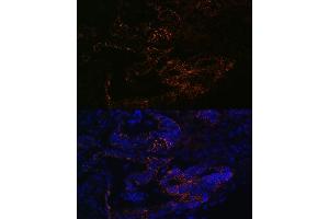 Immunofluorescence (IF) image for anti-Fucosyltransferase 4 (Alpha (1,3) Fucosyltransferase, Myeloid-Specific) (FUT4) (AA 200-300) antibody (ABIN7267274)